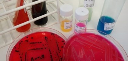 red samples in petri dishes