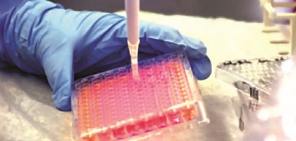tray of samples being filled with a pipette